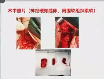 聚焦顯微外科|葫蘆島市醫學會顯微外科學分會第一屆第二次學術會議順利召開(圖5)