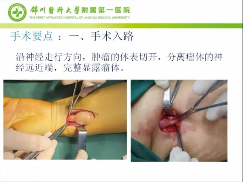 聚焦顯微外科|葫蘆島市醫學會顯微外科學分會第一屆第二次學術會議順利召開(圖13)
