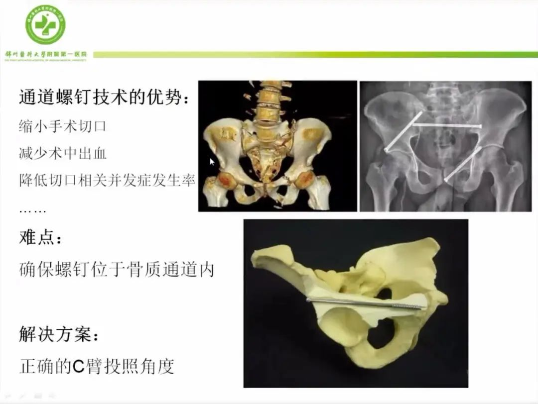 聚焦顯微外科|葫蘆島市醫學會顯微外科學分會第一屆第二次學術會議順利召開(圖11)