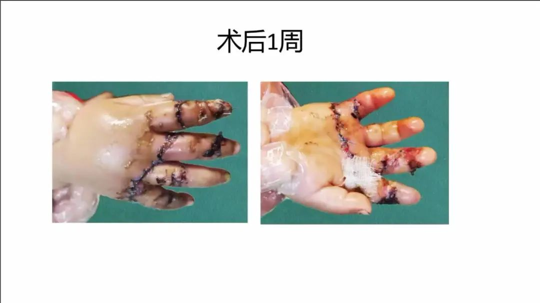 聚焦顯微外科|葫蘆島市醫學會顯微外科學分會第一屆第二次學術會議順利召開(圖25)